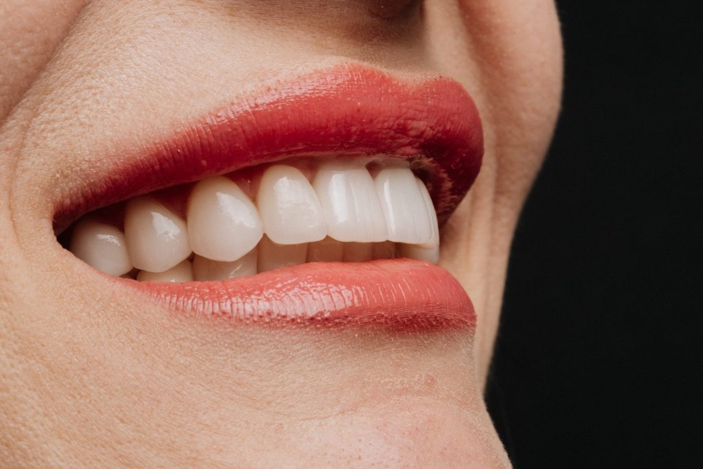 Porcelain Veneers for a Natural-Looking Smile Transformation