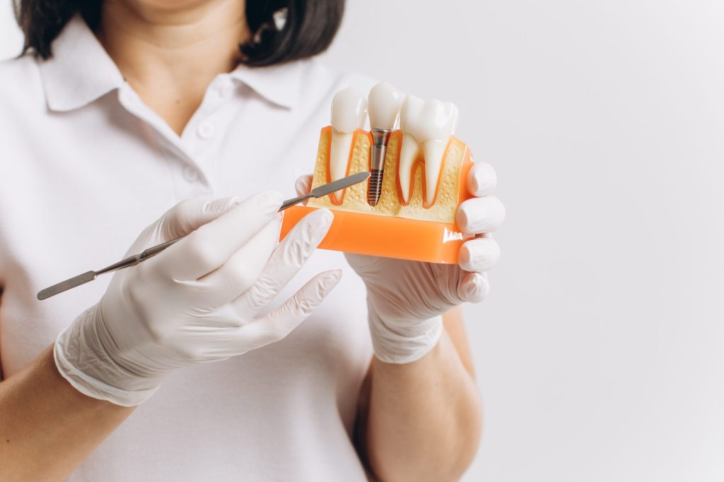 How Dental Implants Restore Missing Teeth and Support Long-Term Oral Health