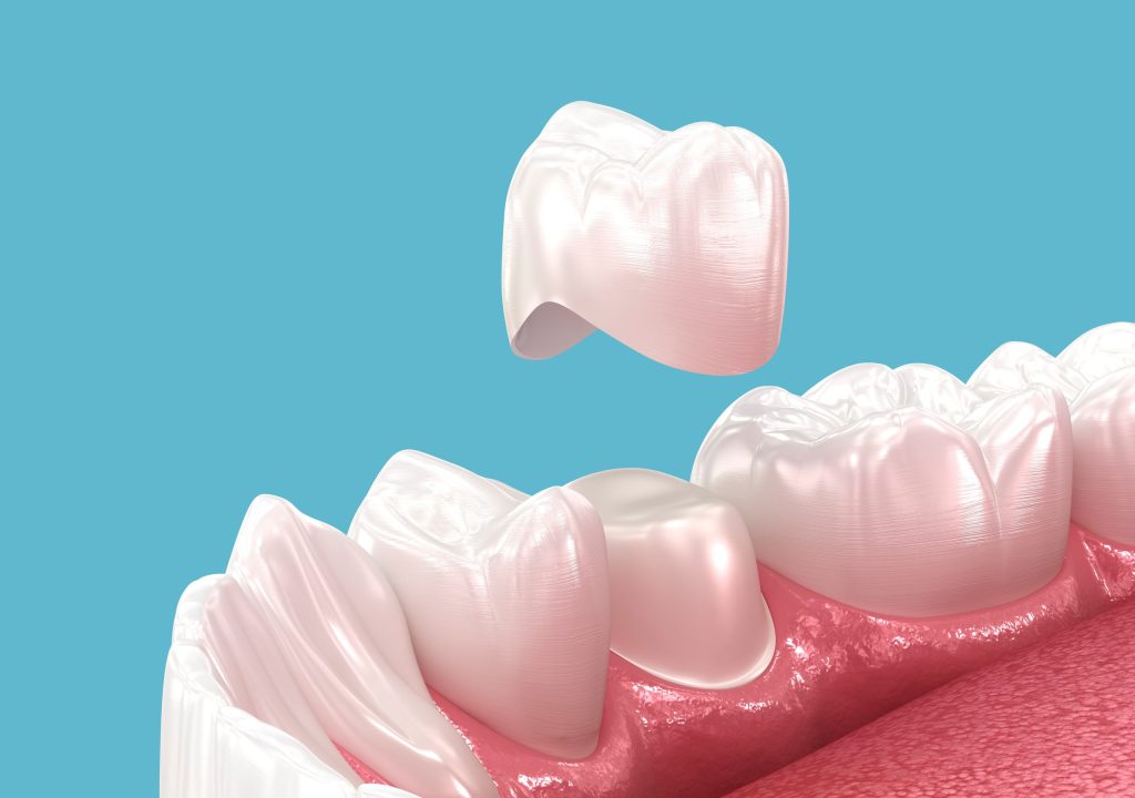 Tooth Pain When You Bite Down: Common Causes and When to Get It Checked